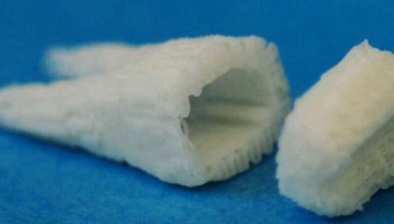 1. Выращивание зубов. Регенерация полноценных коренных зубов у человека