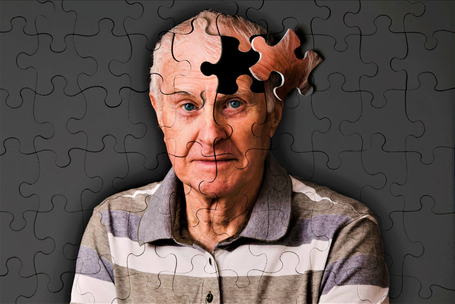 Временное слабоумие. Деменция. Слабоумие. Альцгеймера. Деменция или Альцгеймер.