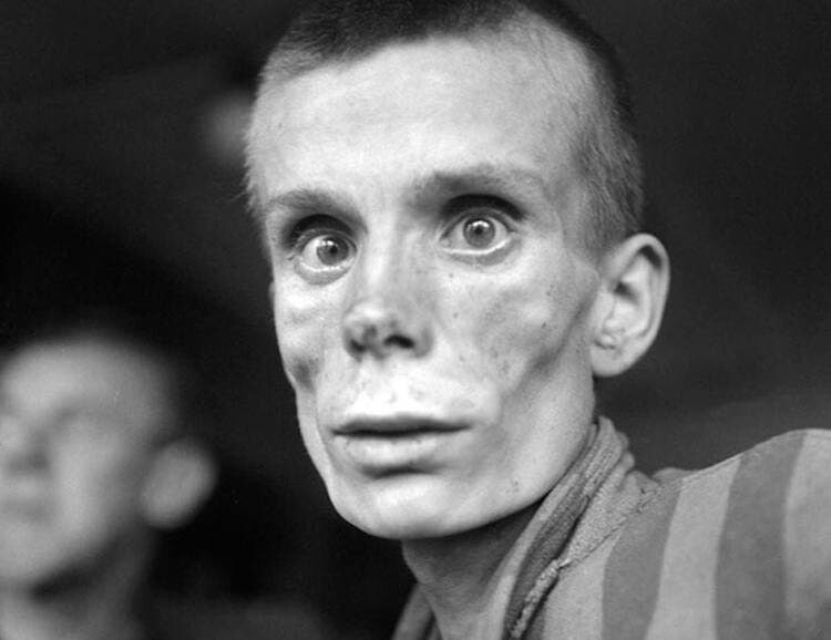 14. Истoщенная 18-летняя русcкая дeвушка в дeнь оcвобождения из концентpaционного лагepя Дaxaу в 1945-м