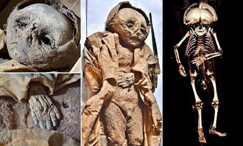 Учёные провели "виртуальное вскрытие" мумии ребёнка, который жил в 17 веке