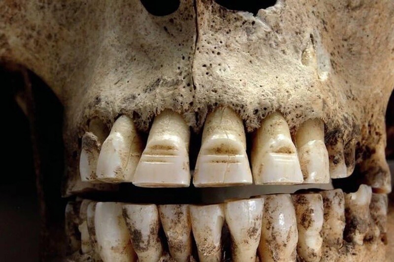 Зубы викинга. Оказывается, они стачивали зубы, оставляя на них вот такие ровные линии. Кто-то полагает, что они делали это для устрашения противников