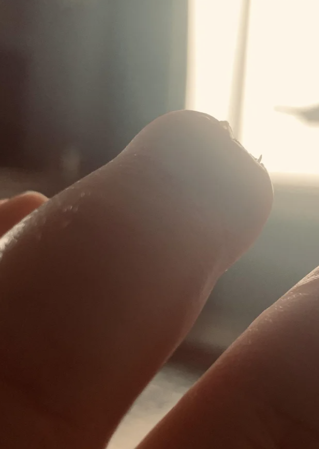4. "Маленькие острые как бритва кусочки ногтей, растущие из кончика моего ампутированного пальца"