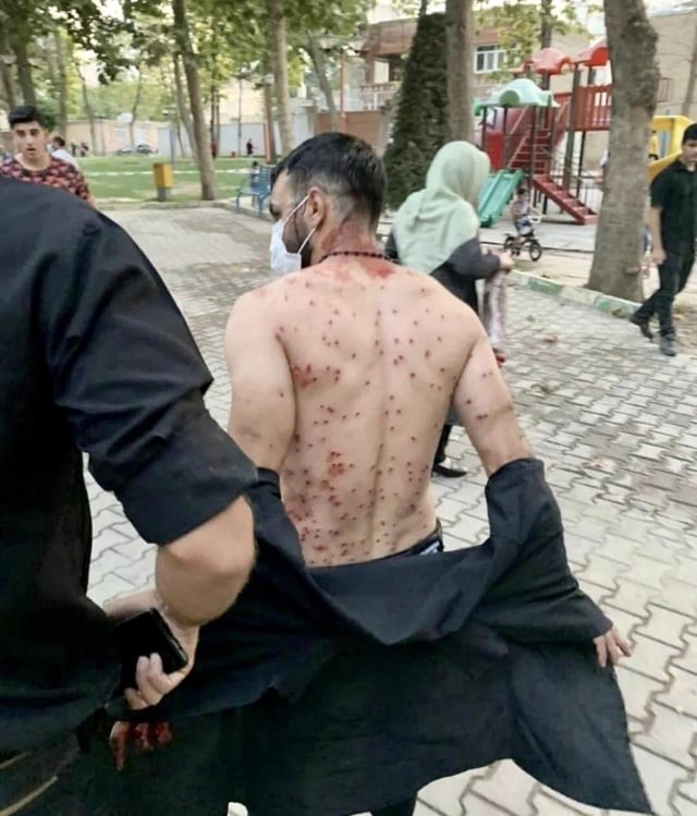 6. Этот мужчина защищал женщин, и загородил их от выстрелов из дробовиков, во время протестов против хиджабов в Иране