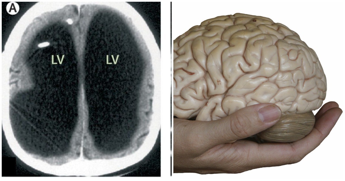 Уровень 90 brain. Деградация мозга институт мозга. У мужчины отсутствует 90 процентов мозга. Фото улучшающий нервную проходимость. Цитаты об обусении мозге воспитании.