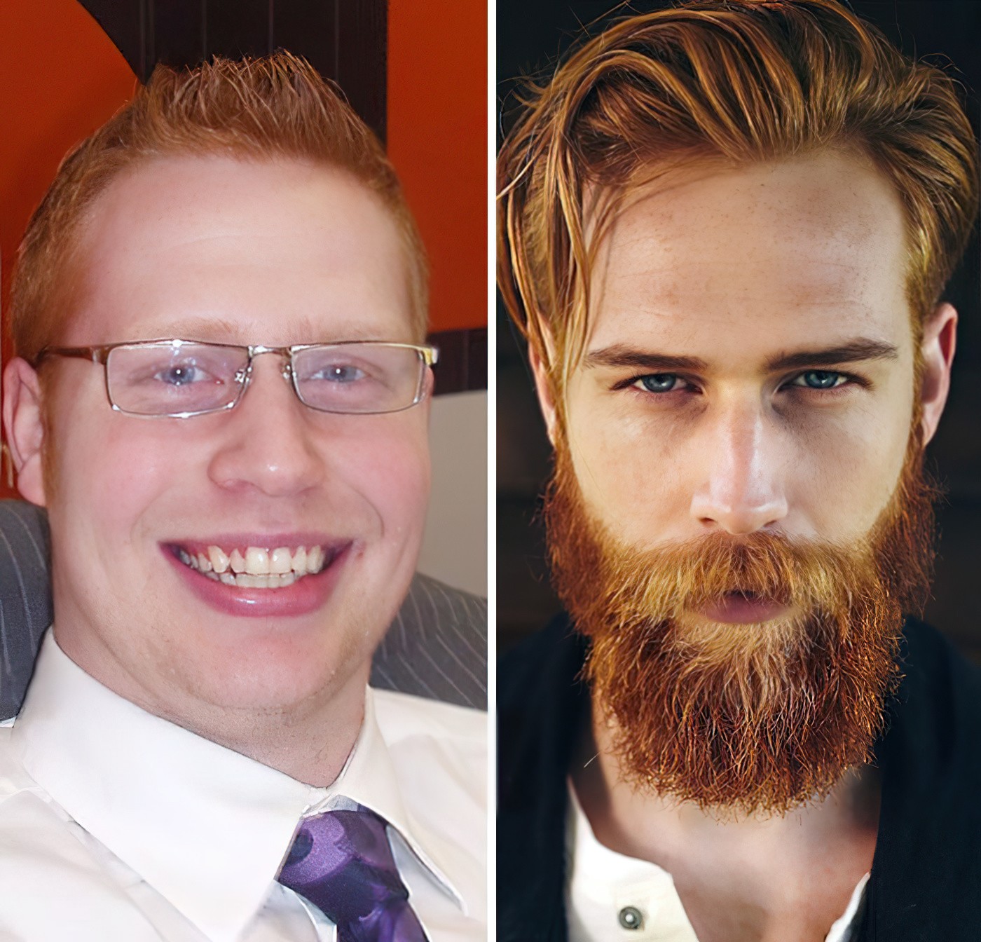 борода в 15 лет фото