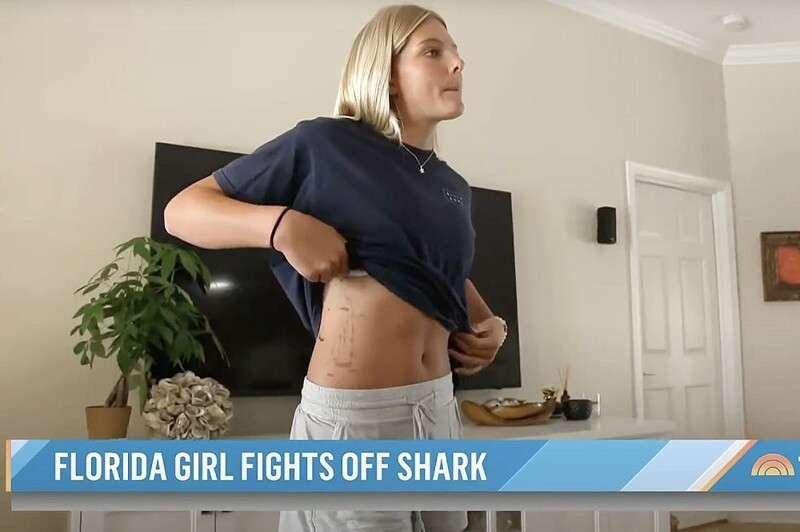 13-летняя американка жестоко избила маленькую акулу