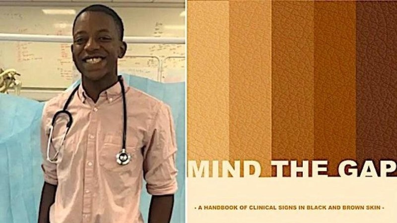 2. 20-летний студент-медик Малон Муквенде написал пособие по диагностике кожных заболеваний на черной и смуглой коже