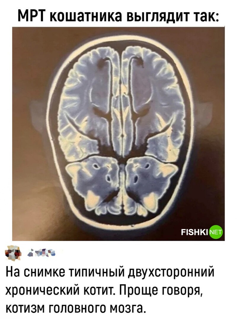 Мяу головного мозга