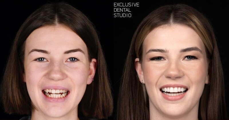 15 фото до и после того, как люди обратились к стоматологу