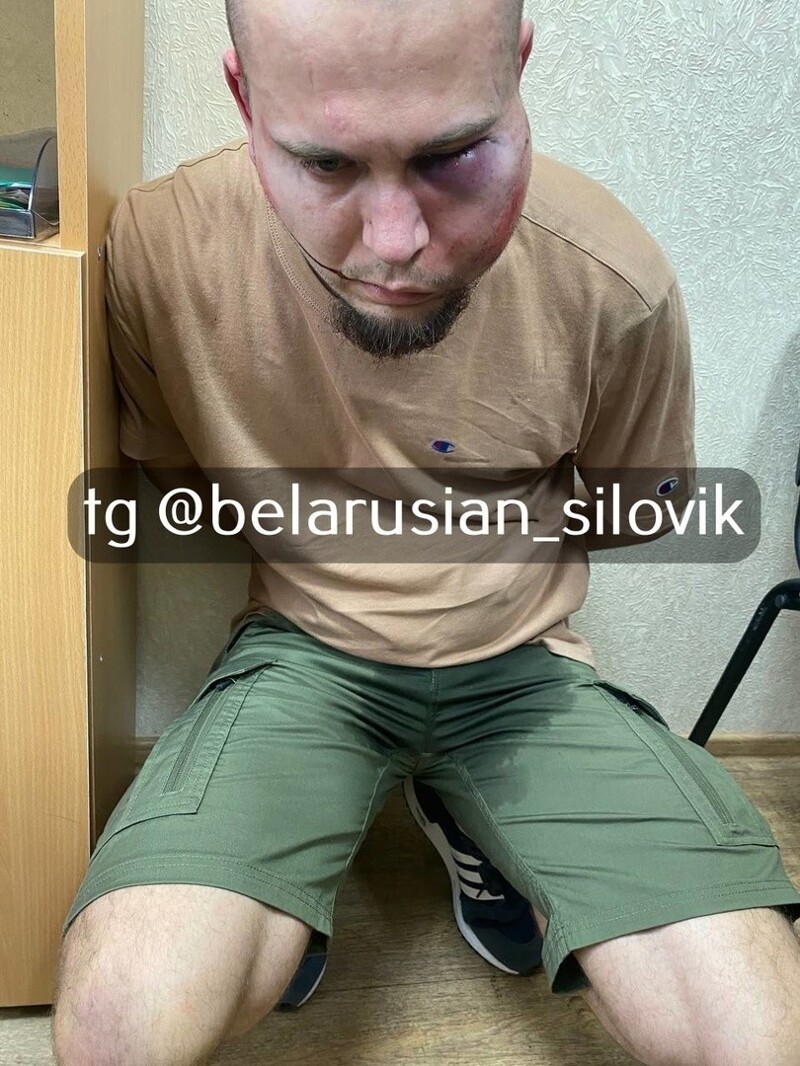 В Беларуси задержан врач-нацист со своим другом, которые на стриме зиговали и радовались смертям российских и белорусских граждан в "Крокус Сити Холл"