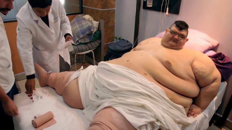 Как изменился самый толстый человек в мире