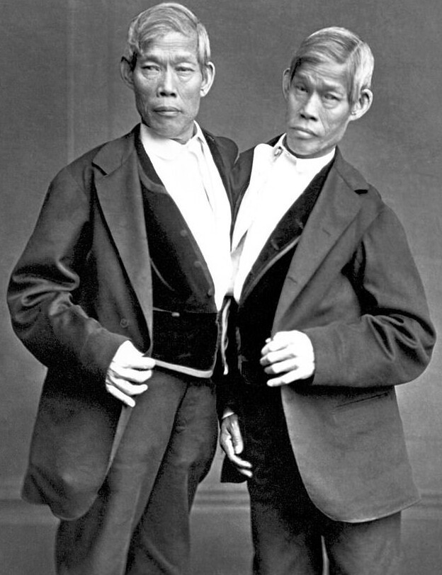 История братьев Банкер, благодаря которым появился термин "сиамские близнецы"