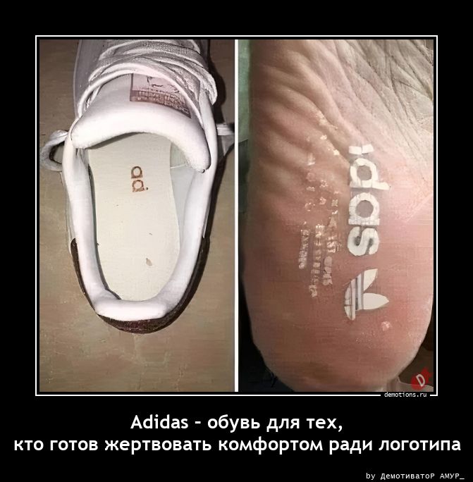 Adidas – обувь для тех, кто готов жертвовать комфортом ради логотипа