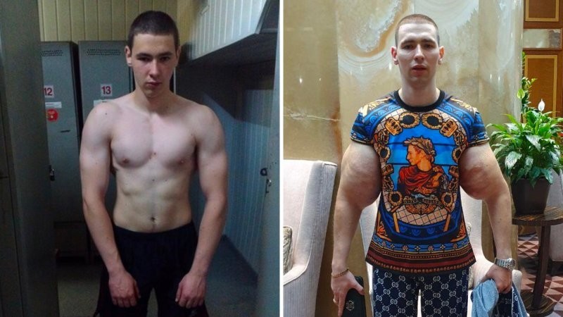 Вазелиновый качок по прозвищу Руки-Базуки попал в больницу
