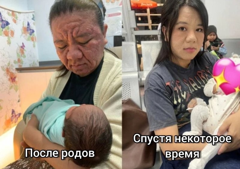 28-летняя девушка из-за беременности постарела до неузнаваемости