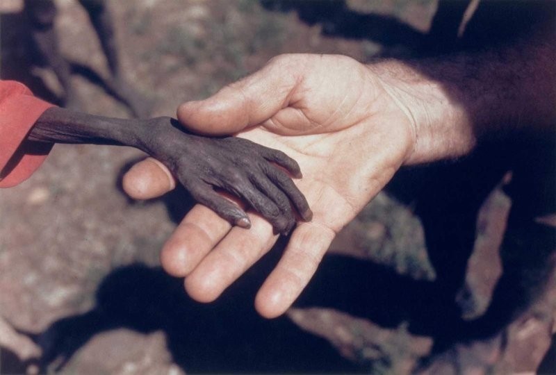 3. Голодающий мальчик и миссионер в Уганде, 1980 год