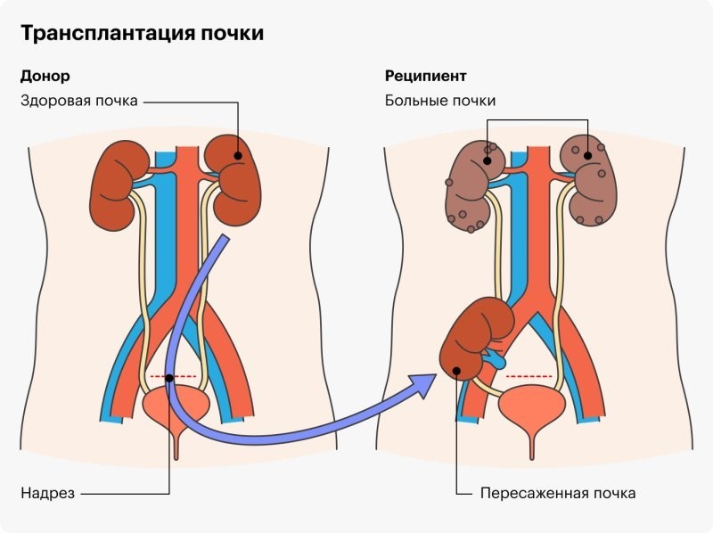 3. Не замена, а дополнение