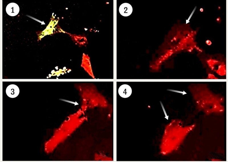 Учёные: сердце человека обладает способностью к самовосстановлению