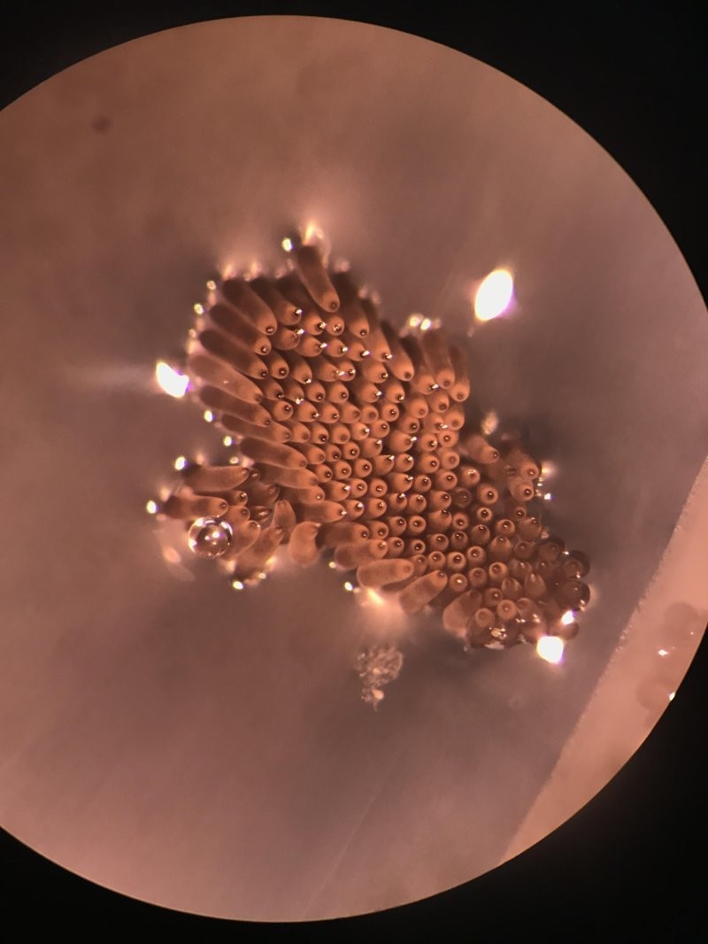 17. Яйца комара