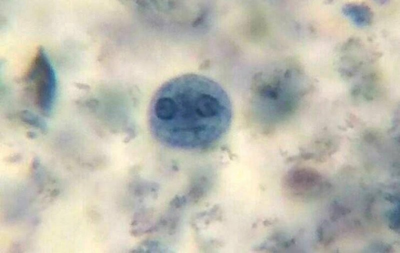 18. Амёба, которая выглядит удивительно человечной