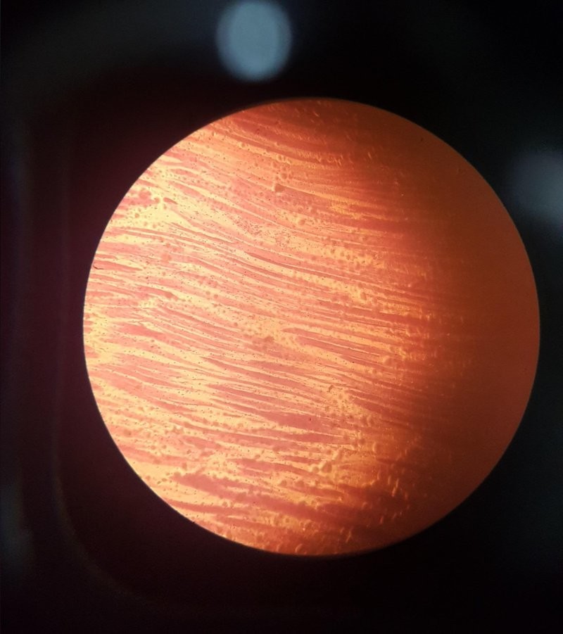 9. Сердечная мышца