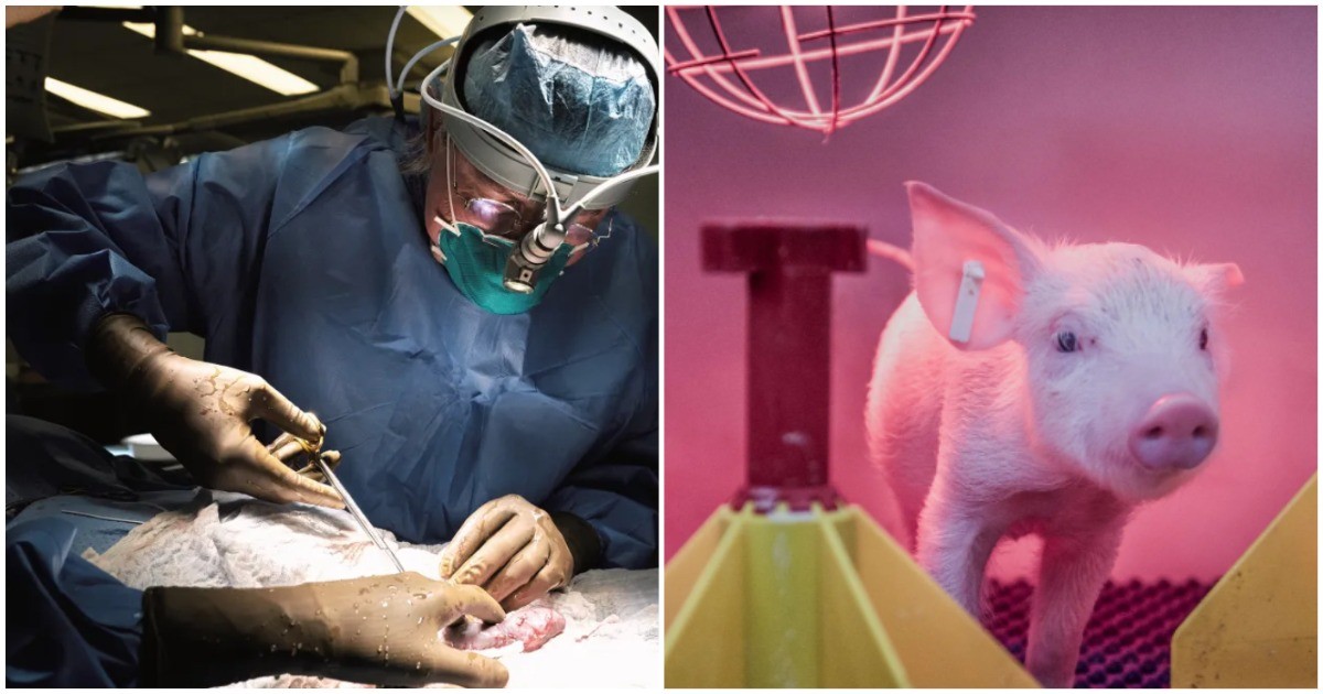 От свиньи к человеку: свиные почки скоро превзойдут человеческие в трансплантации органов