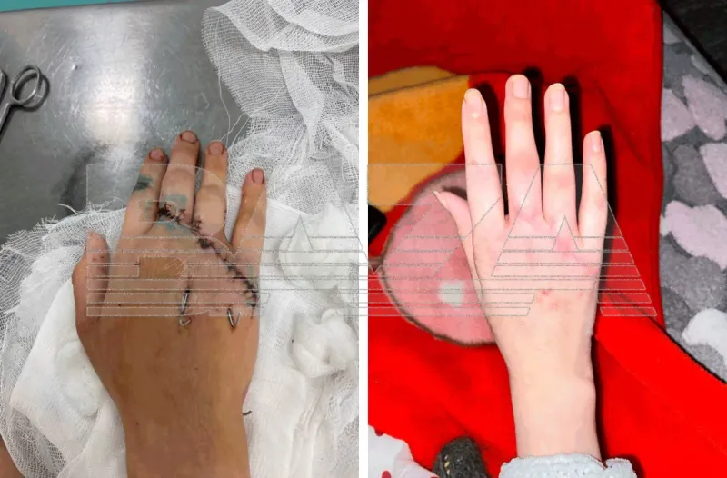 Переехал коньком: 23-летняя девушка получила тяжелые травмы на катке