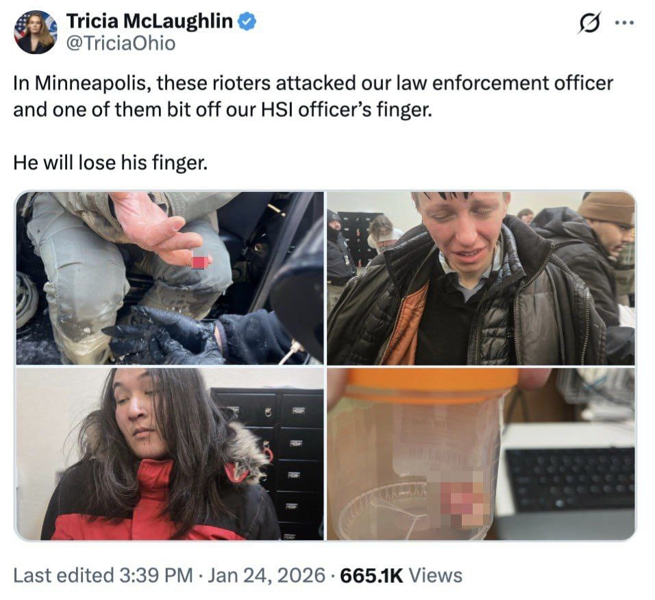 Третья неделя "цивилизованной" войны в Миннесоте