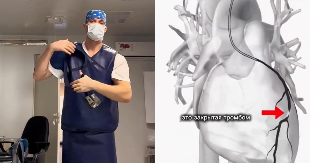 Сердце остановилось на 50 минут: хирурги восстановили кровоток и спасли пациентку