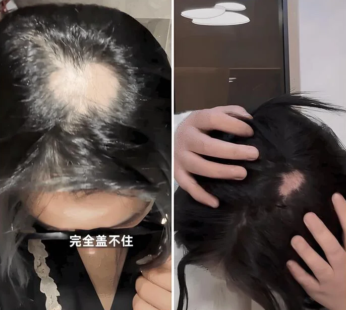 В Китае набирает популярность необычный тренд — увеличение формы головы