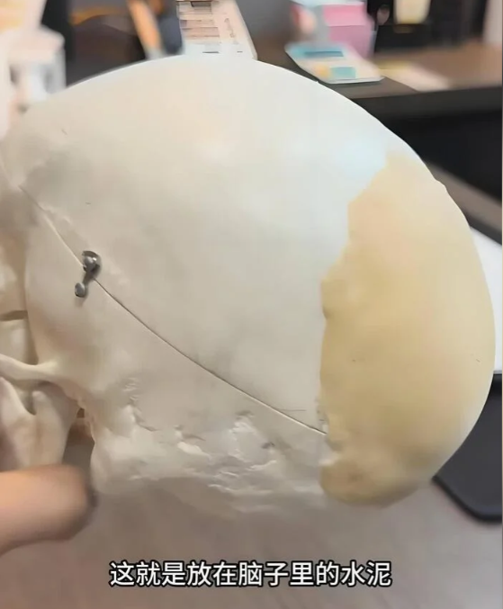 В Китае набирает популярность необычный тренд — увеличение формы головы