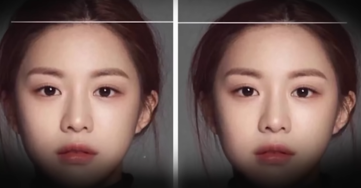 В Китае набирает популярность необычный тренд — увеличение формы головы