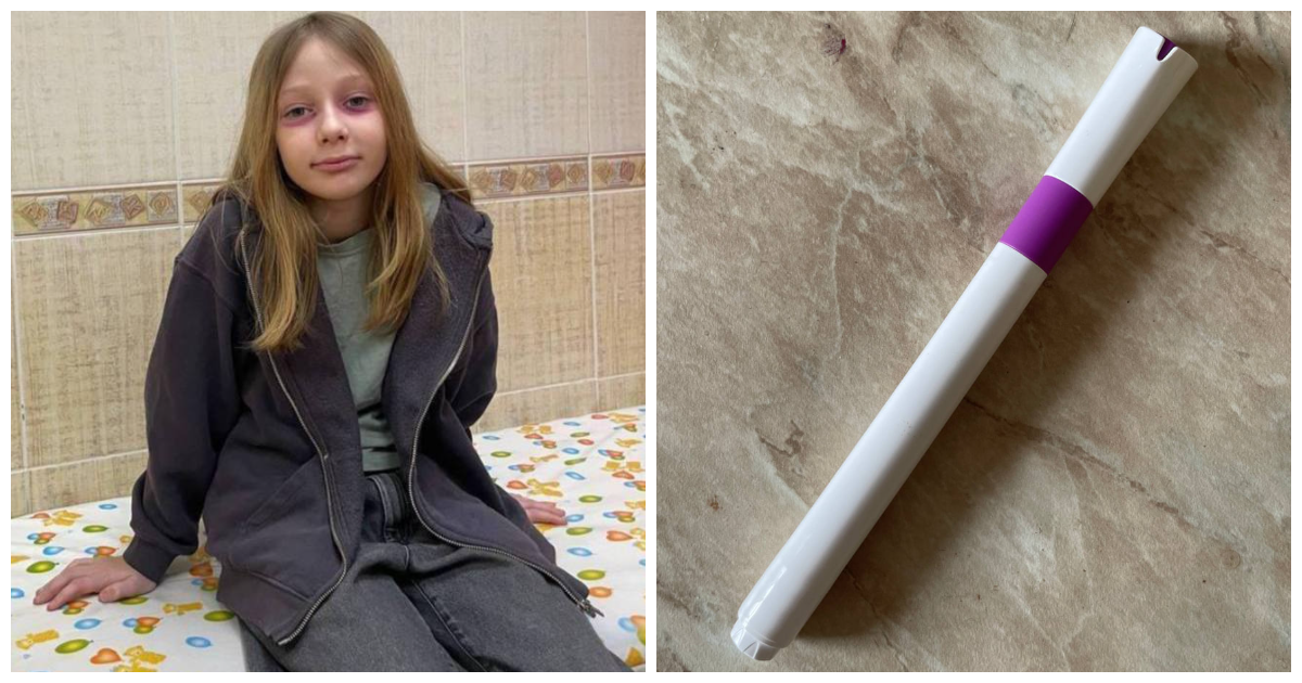 Женщина неделю лечила 10-летнюю дочь от редкой болезни, которую та нарисовала себе под глазами