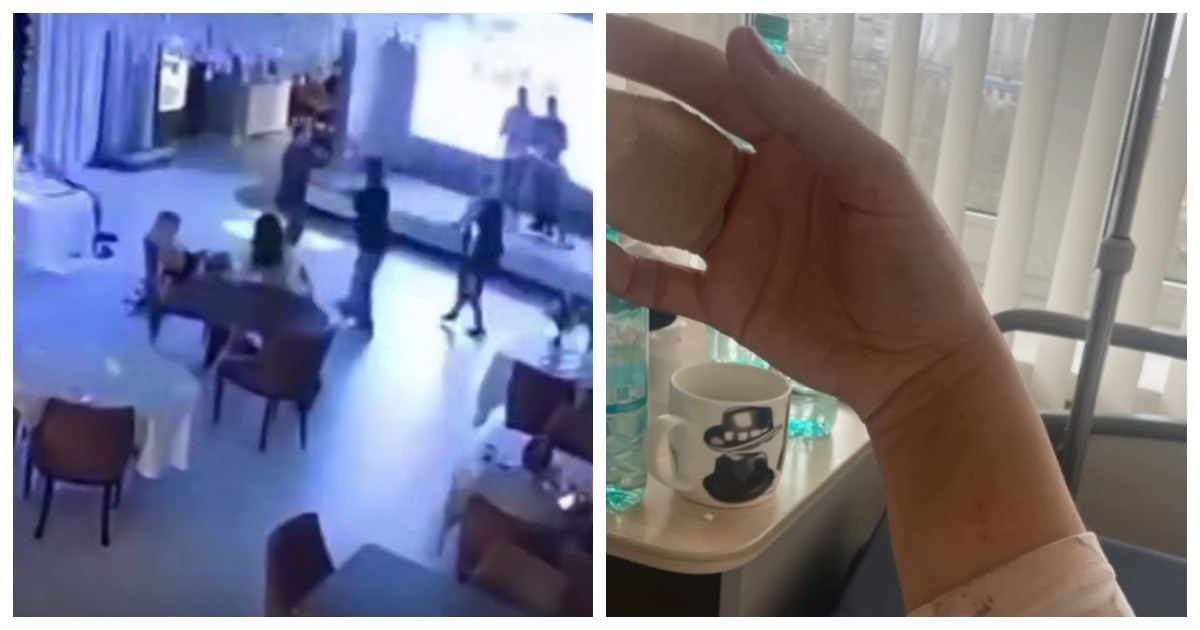 Женщина лишилась двух фаланг пальцев, упав вместе со столом