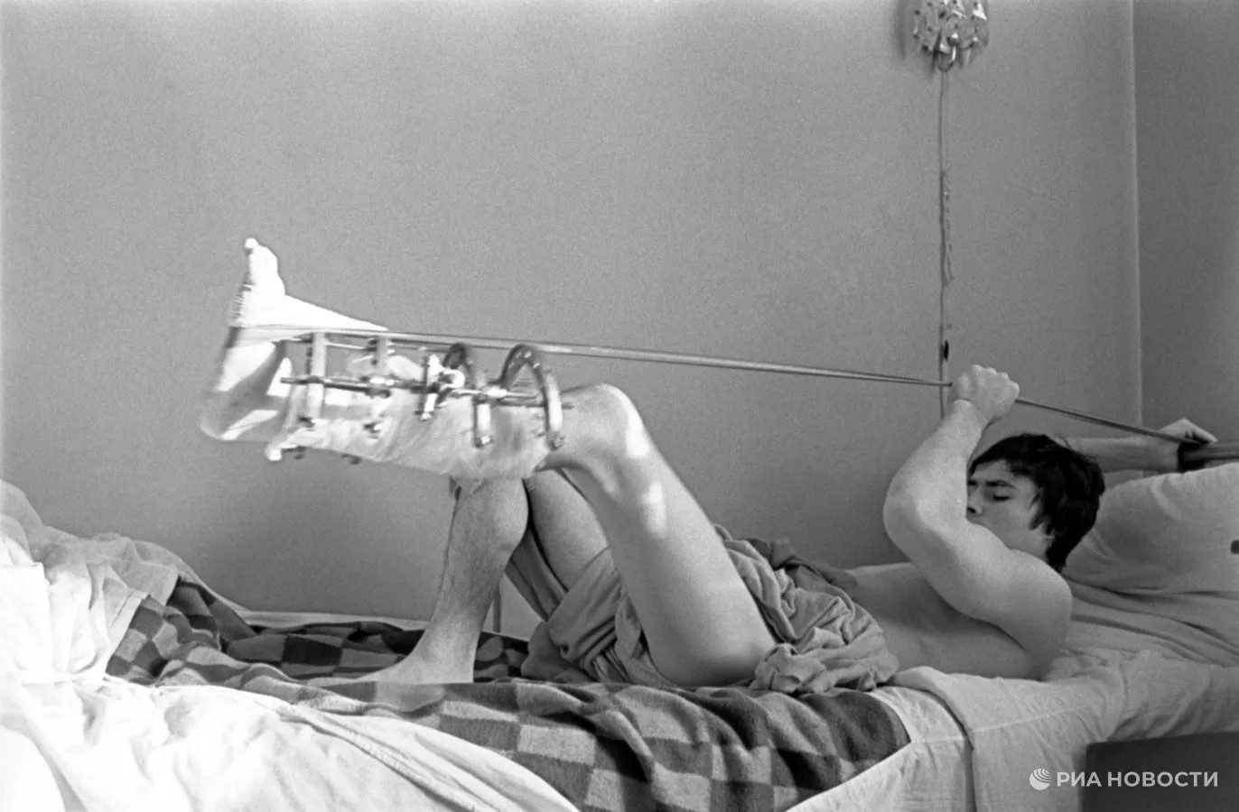 Трехкратный Олимпийский чемпион, двукратный абсолютный чемпион мира по спортивной гимнастике Дмитрий Владимирович Билозерчев с аппаратом Илизарова после травмы