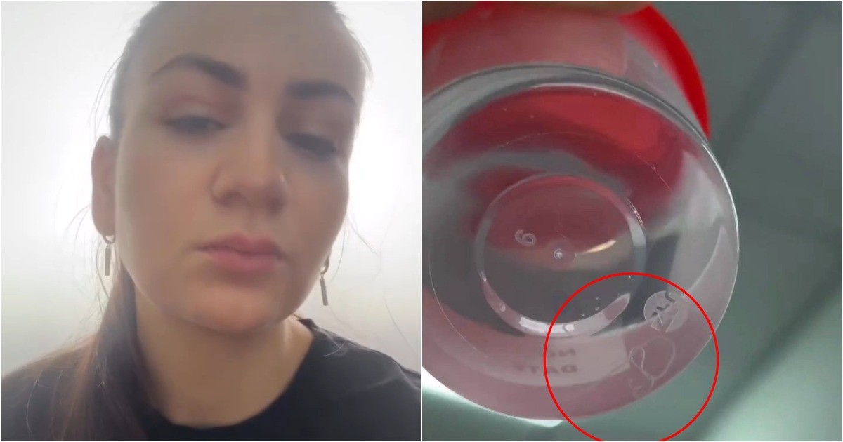 Опасный укус: комар занёс паразита в глаз жительницы Дагестана