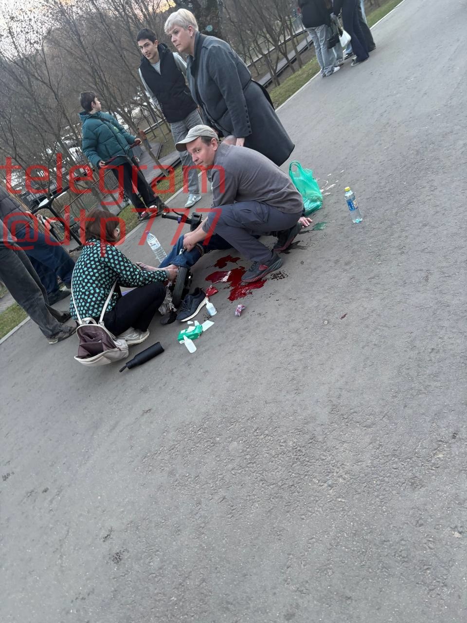 В Москве самокатчица покалечила пенсионера