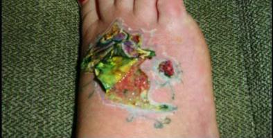 А потом на месте тату будет это !