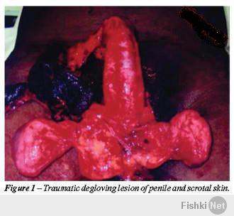 Ну... я бы не сказал, что совсем нечего показывать)))