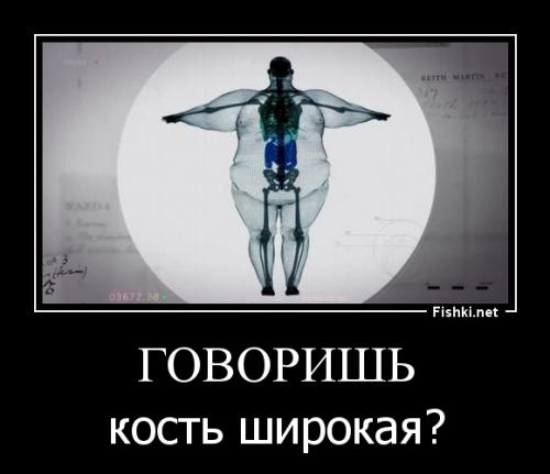 Рентгеновский снимок тела 400-килограммового мужчины 