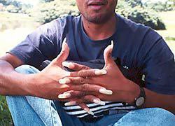 А если ногти длинные в моду войдут, тоже все поведутся?