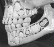 Челюсть ребенка до того как все зубы поменяются, вот уж я был в шоке когда увидел :)
