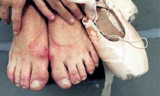 Цена аплодисментов