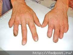 Он кормил рыбок!