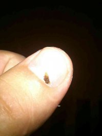 сочувстую! у меня 4мм нашли на днях а левой почке! а вот фото того нашего героя!