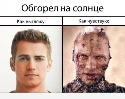 14 людей, забавно обгоревших на солнце