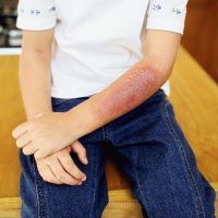 ИМХО: нельзя такие посты выкладывать. Лето, каникулы... Сегодня - пост в тырнетах. А завтра? "Мама, мама! Я обжегся!"???