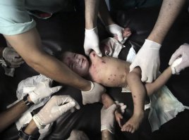 А где снимки детей из с сектора Газа, только погибших или раненых во время "нерушимой б.л.я. скалы"??