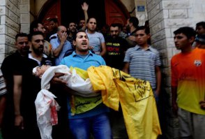 А где снимки детей из с сектора Газа, только погибших или раненых во время "нерушимой б.л.я. скалы"??