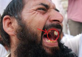 Нафига мужику зуб-то стёрли? :)